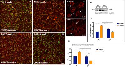 Neuroimmune pathways involvement in neurodegeneration of R6/2 mouse model of Huntington’s disease